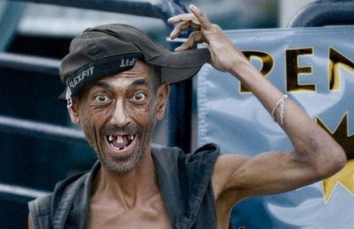 ... jumatatile de adevar pot duce la tulburari grave de auz ...